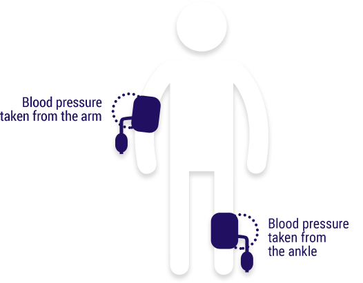 Stick figure with blood pressure sensors on the arm and ankle.